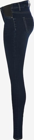 ARIZONA Skinny Hose in Blau