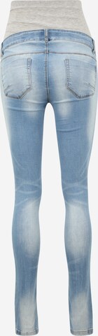 MAMALICIOUS Slimfit Jeans in Blauw