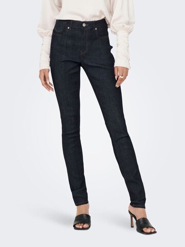 Skinny Jeans di ONLY in nero: frontale