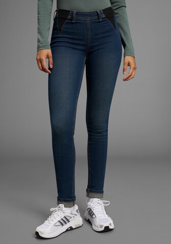 ARIZONA Skinny Jeans in Blue: front