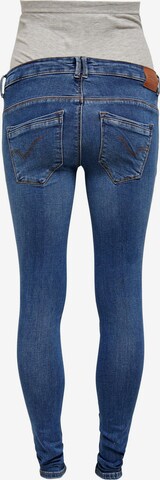 Skinny Jeans 'Paola' de la Only Maternity pe albastru