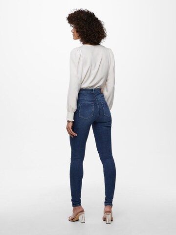 ONLY Skinny Jeans 'Forever' in Blau