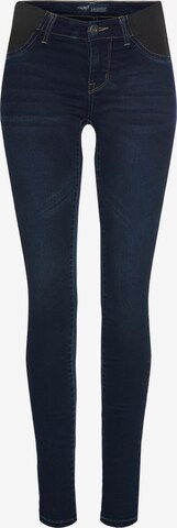 ARIZONA Skinny Jeans in Blue: front