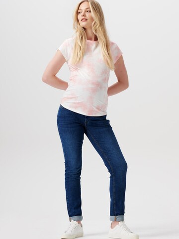 Esprit Maternity - Camisa em rosa: frente