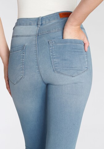 ONLY Skinny Jeans in Blue
