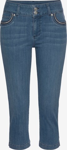 LASCANA Skinny Jeans in Blue: front