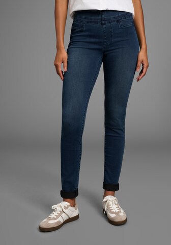 ARIZONA Skinny Jeans in Blue: front
