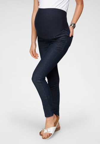 Neun Monate Skinny Jeans in Blue: front