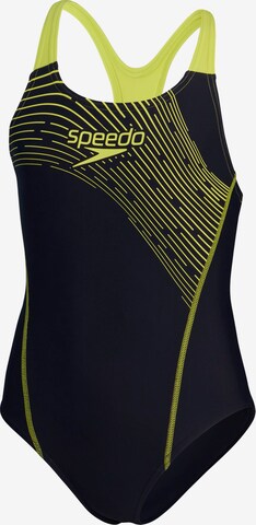 SPEEDO Badeanzug in Schwarz: predná strana