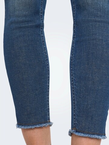 ONLY Skinny Jeans 'ONLBLUSH' in Blue: front