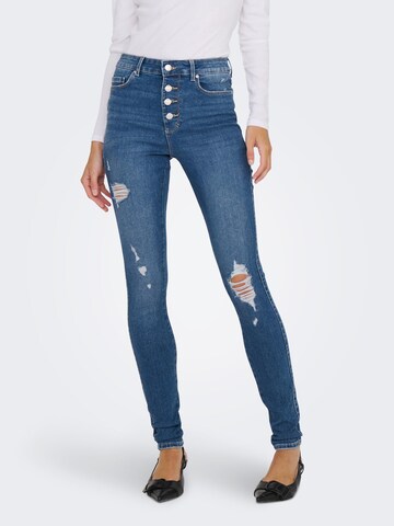 Skinny Jeans 'JOSIE' di ONLY in blu: frontale