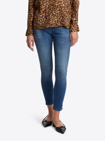 Rich & Royal Skinny Jeans in Blue: front