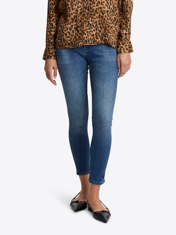 Rich & Royal Skinny Jeans in Blue: front