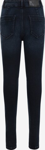 WE Fashion Skinny Jeans in Blauw