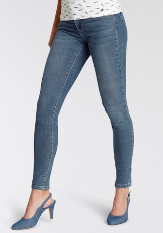 ARIZONA Skinny Jeans in Blue: front