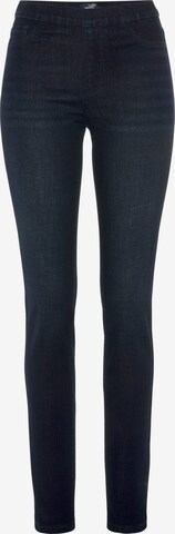 ARIZONA Skinny Jeans in Blue: front