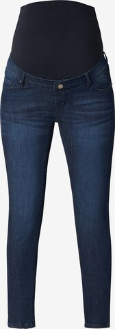 Noppies Skinny Jeans 'Avi' in Blauw: voorkant