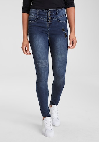 ARIZONA Skinny Jeans in Blue: front