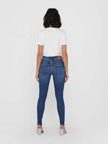 ONLY Skinny Jeans 'Bobby' in Blau