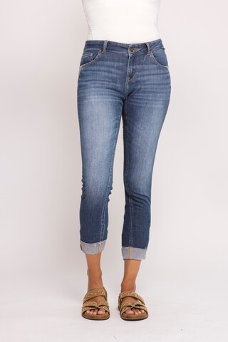 Zhrill Skinny Jeans in Blue: front