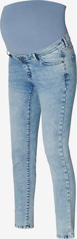 Supermom Skinny Jeans 'Austin' in Blauw: voorkant