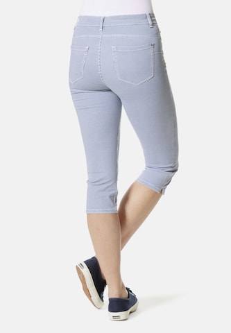 STOOKER WOMEN Skinny Jeans in Blau