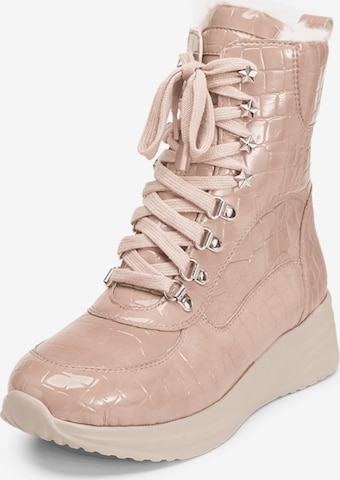 VITAFORM Veterlaarsjes in Roze: voorkant