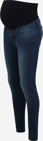 Envie de Fraise Skinny Jeans 'CLINT' in Blue: front