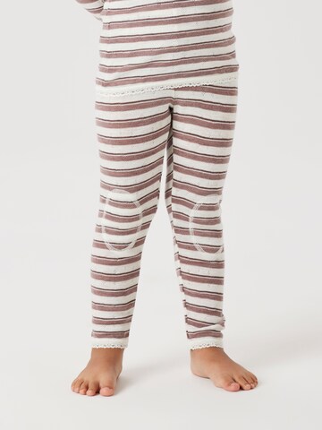 NAME IT Skinny Pajkice 'NMFWANG' | roza barva: sprednja stran