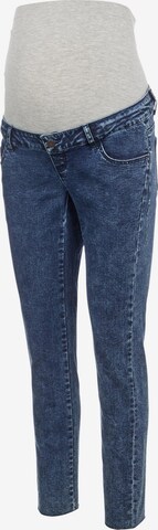 MAMALICIOUS Slimfit Jeans 'Ventura' in Blau: predná strana