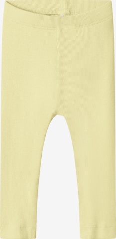 geltona NAME IT Siauras Tamprės 'NBNKab': priekis