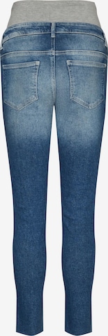 MAMALICIOUS Slimfit Jeans 'AKOSTA' in Blauw