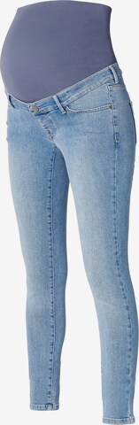 Noppies Skinny Jeans 'Avi' in Blauw: voorkant