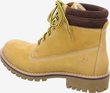Franz Ferdinand Lace-Up Ankle Boots in Yellow