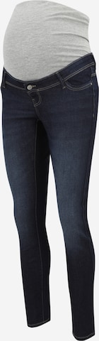 mėlyna Only Maternity Siauras Džinsai 'WAUW': priekis