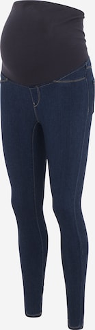 Skinny Jeggings 'Rain' Only Maternity en bleu : devant