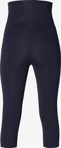 Skinny Leggings 'Ales' Noppies en bleu