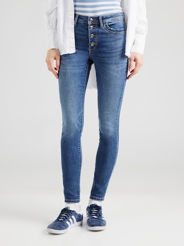 ONLY Skinny Jeans 'ONLWINNIE' in Blauw: voorkant