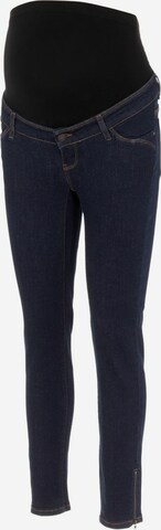 MAMALICIOUS Slimfit Jeans i blå: forside