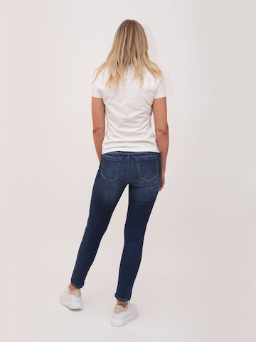 Miracle of Denim Slimfit Jeans in Blauw