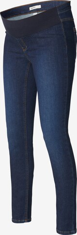 Esprit Maternity Skinny Jeggings in Blau: predná strana