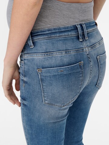 Only Maternity Skinny Jeans in Blau