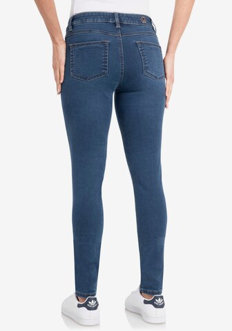 wonderjeans Skinny Jeans in Blau