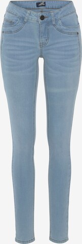 ARIZONA Skinny Jeans in Blue: front