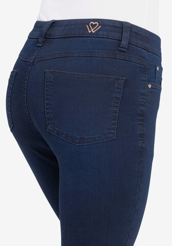 wonderjeans Skinny Jeans in Blue