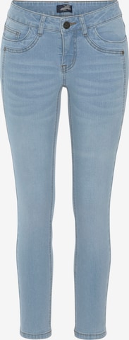 ARIZONA Skinny Jeans in Blau: Vorderseite