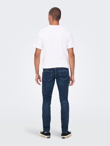 Only & Sons Baggy Jeans 'Loom' in Blue