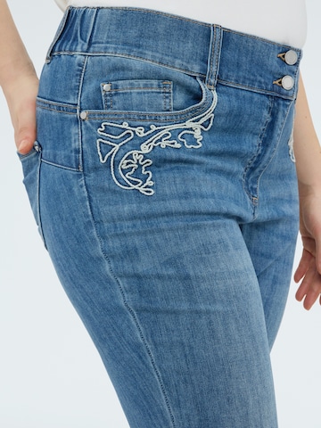 Fiorella Rubino Skinny Jeans in Blauw