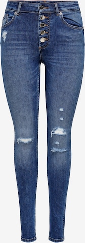 ONLY Skinny Jeans 'Bobby' i blå: forside