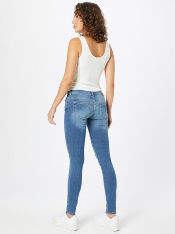 Skinny Jeans 'Colar' di ONLY in blu